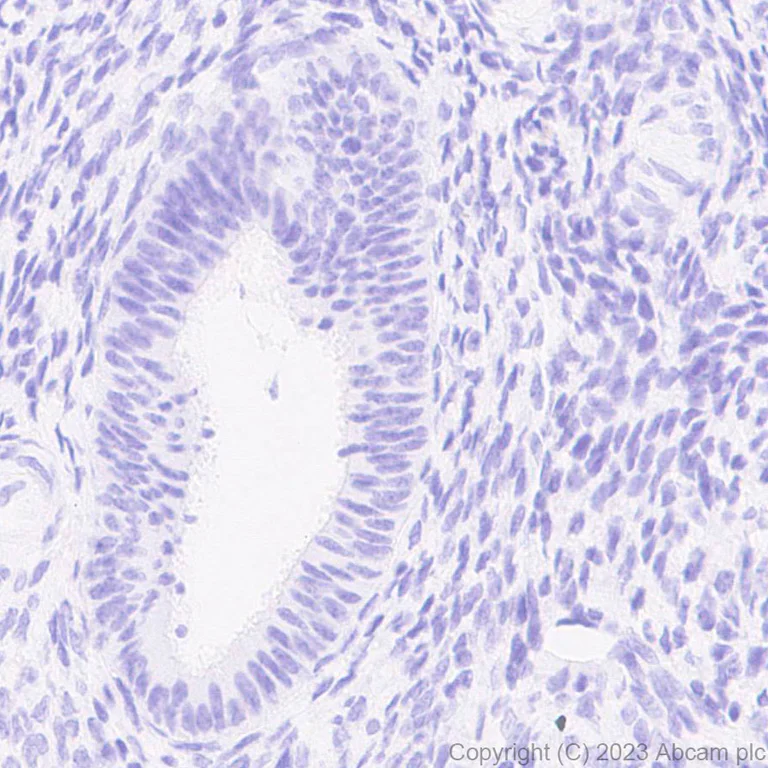 Immunohistochemistry (Formalin/PFA-fixed paraffin-embedded sections) - Anti-Influenza A virus PB1 antibody [EPR28248-26] (AB313887)