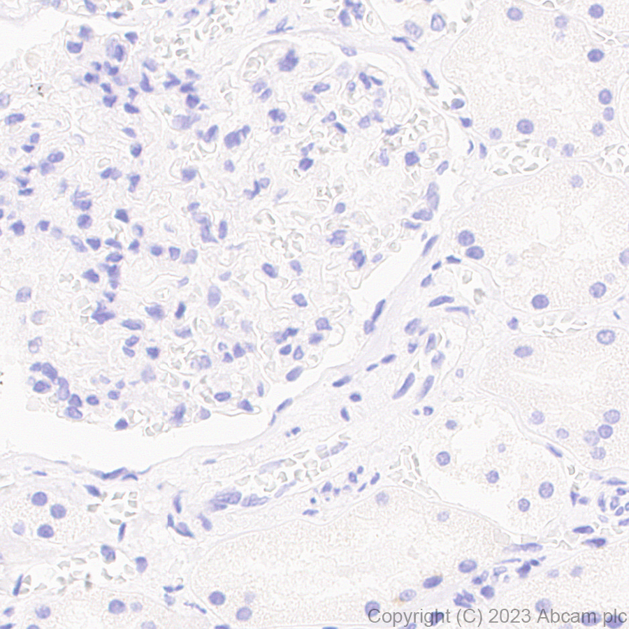Immunohistochemistry (Formalin/PFA-fixed paraffin-embedded sections) - Anti-Influenza A Virus PB2 protein antibody [EPR28249-46] (AB312856)