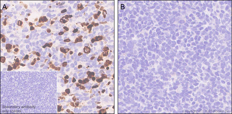 Immunohistochemistry (Formalin/PFA-fixed paraffin-embedded sections) - Anti-Influenza A Virus PB2 protein antibody [EPR28249-46] - BSA and Azide free (AB312857)