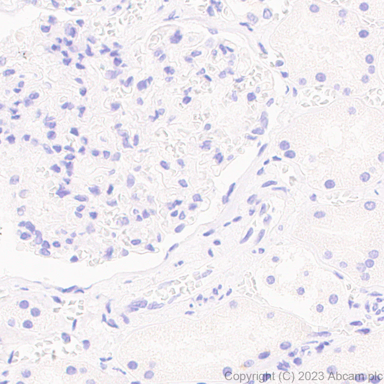 Immunohistochemistry (Formalin/PFA-fixed paraffin-embedded sections) - Anti-Influenza A Virus PB2 protein antibody [EPR28249-46] - BSA and Azide free (AB312857)