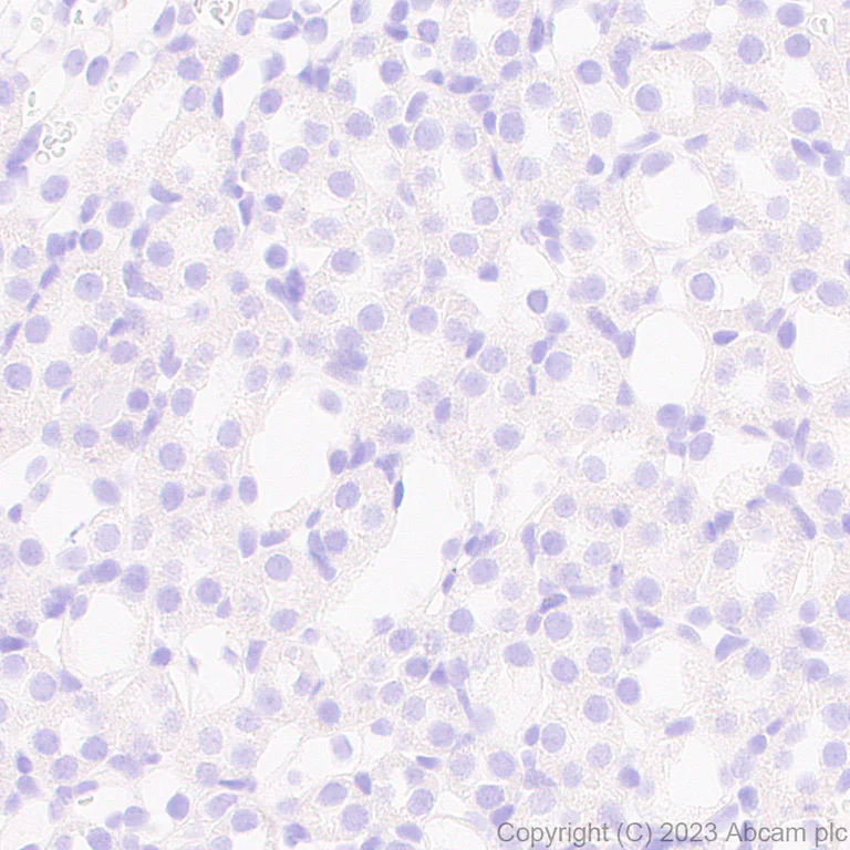 Immunohistochemistry (Formalin/PFA-fixed paraffin-embedded sections) - Anti-Influenza A Virus PB2 protein antibody [EPR28249-46] - BSA and Azide free (AB312857)