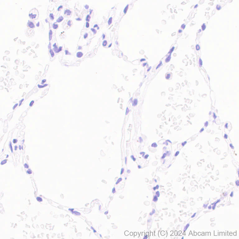 Immunohistochemistry (Formalin/PFA-fixed paraffin-embedded sections) - Anti-Influenza A Virus PB2 protein antibody [EPR29356-84] (AB320835)