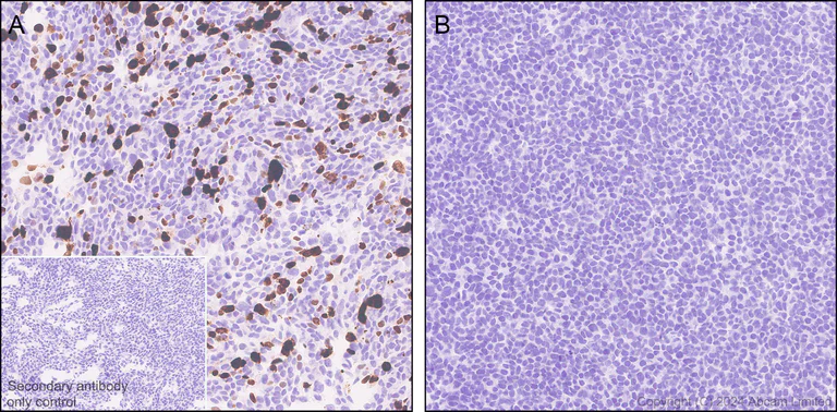 Immunohistochemistry (Formalin/PFA-fixed paraffin-embedded sections) - Anti-Influenza A Virus PB2 protein antibody [EPR29356-84] - BSA and Azide free (AB320836)