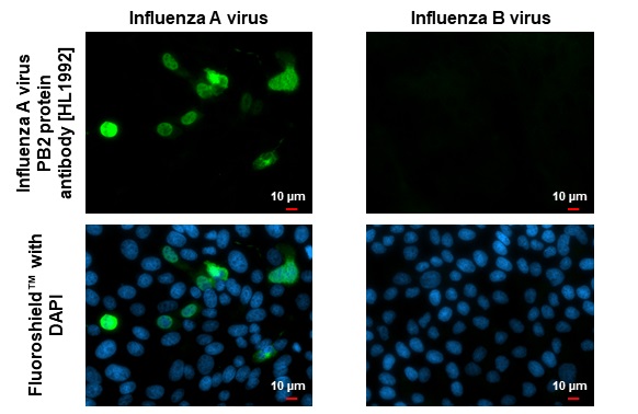 Immunocytochemistry/ Immunofluorescence - Anti-Influenza A virus PB2 protein antibody [HL1992] (AB308216)