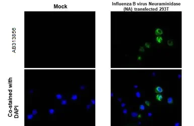 Immunohistochemistry (Formalin/PFA-fixed paraffin-embedded sections) - Anti-Influenza B Virus Neuraminidase antibody [HL1476] - BSA and Azide free (AB313856)