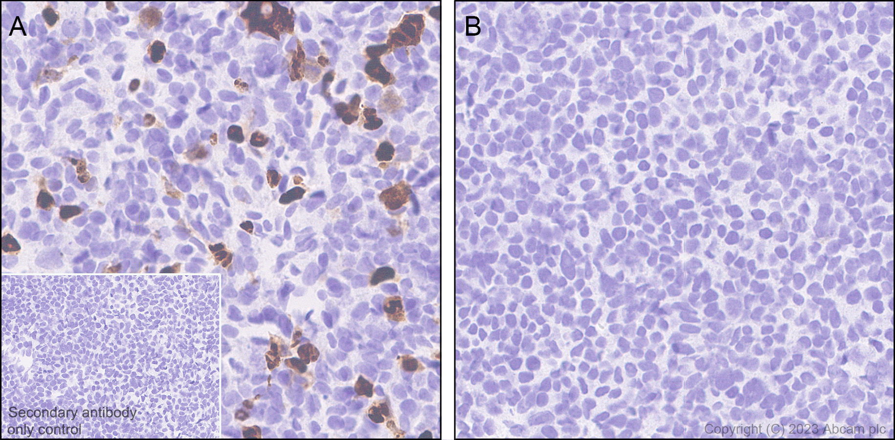 Immunohistochemistry (Formalin/PFA-fixed paraffin-embedded sections) - Anti-Influenza B virus Nucleoprotein antibody [EPR28205-27] (ab313885), expandable thumbnail