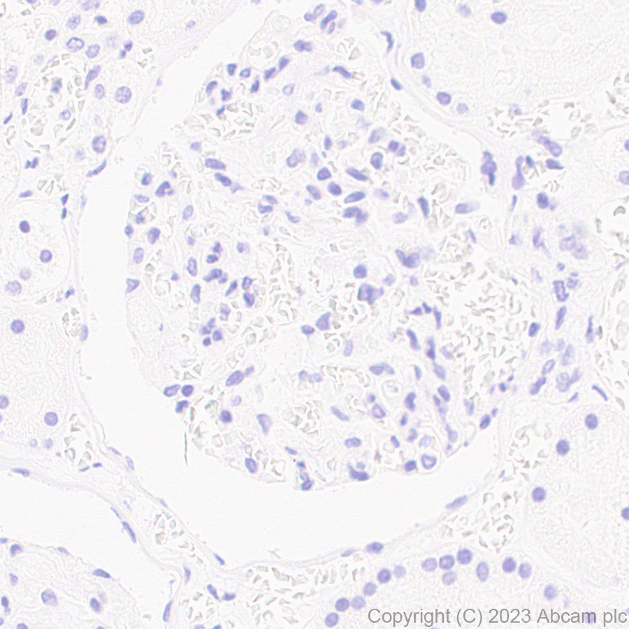 Immunohistochemistry (Formalin/PFA-fixed paraffin-embedded sections) - Anti-Influenza B virus Nucleoprotein antibody [EPR28205-27] (AB313885), expandable thumbnail