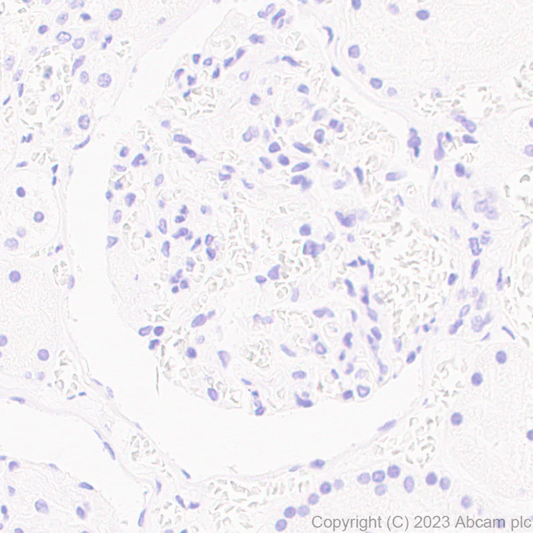 Immunohistochemistry (Formalin/PFA-fixed paraffin-embedded sections) - Anti-Influenza B virus Nucleoprotein antibody [EPR28205-27] (AB313885)