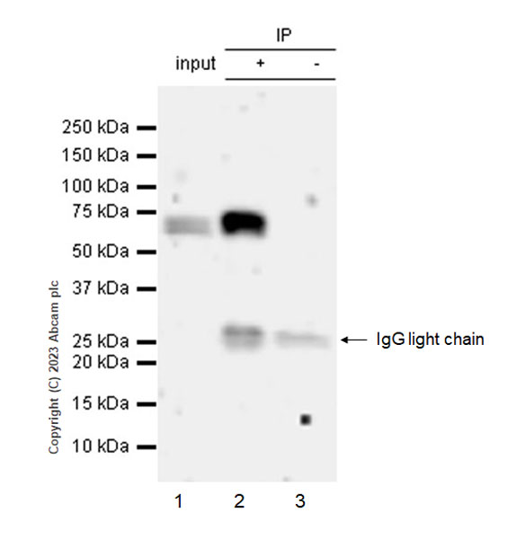 Immunoprecipitation - Anti-Influenza B virus Nucleoprotein antibody [EPR28205-27] (AB313885), expandable thumbnail