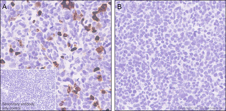 Immunohistochemistry (Formalin/PFA-fixed paraffin-embedded sections) - Anti-Influenza B virus Nucleoprotein antibody [EPR28205-27] - BSA and Azide free (AB313886)