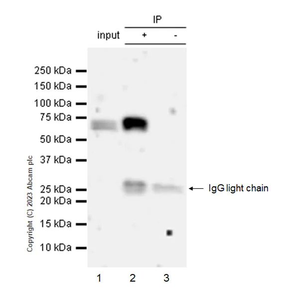 Immunoprecipitation - Anti-Influenza B virus Nucleoprotein antibody [EPR28205-27] - BSA and Azide free (AB313886)