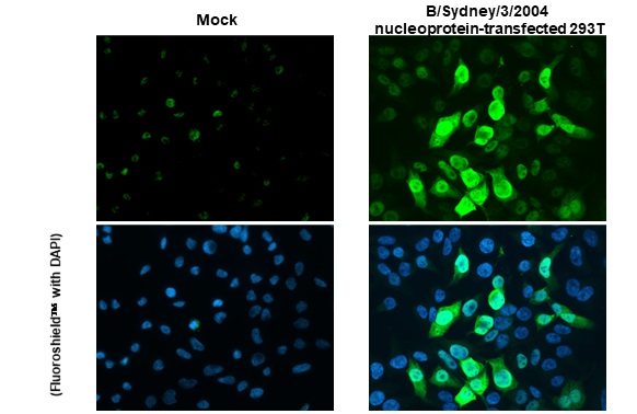 Immunocytochemistry/ Immunofluorescence - Anti-Influenza B virus Nucleoprotein antibody [HL1073] (ab308414), expandable thumbnail