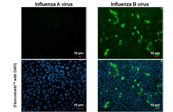 Immunocytochemistry/ Immunofluorescence - Anti-Influenza B virus Nucleoprotein antibody [HL1073] (AB308414), expandable thumbnail