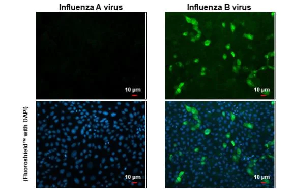 Immunocytochemistry/ Immunofluorescence - Anti-Influenza B virus Nucleoprotein antibody [HL1073] (AB308414)