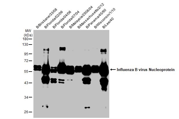 Western blot - Anti-Influenza B virus Nucleoprotein antibody [HL1073] (AB308414), expandable thumbnail