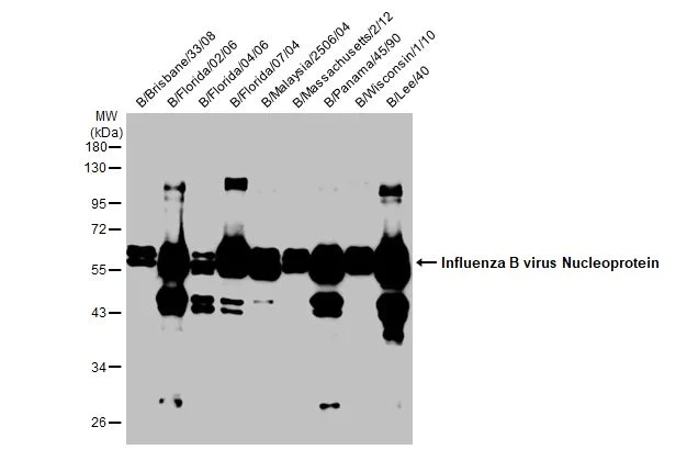 Western blot - Anti-Influenza B virus Nucleoprotein antibody [HL1073] (AB308414)