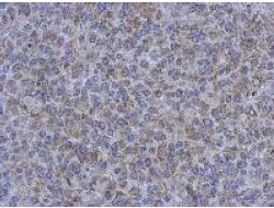 Immunohistochemistry (Formalin/PFA-fixed paraffin-embedded sections) - Anti-Influenza Virus NS1A Binding Protein antibody (AB127566)