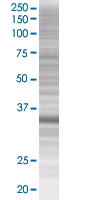 ING1 overexpression 293T lysate (whole cell)