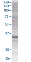 SDS-PAGE - ING1 overexpression 293T lysate (whole cell) (AB94300)
