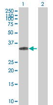 Western blot - ING1 overexpression 293T lysate (whole cell) (AB94300)