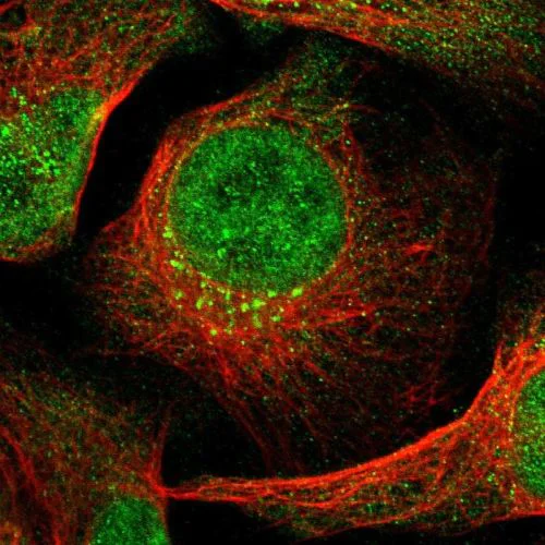 Immunocytochemistry/ Immunofluorescence - Anti-ING2 antibody (AB244387)