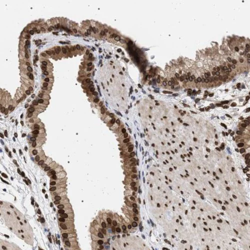 Immunohistochemistry (Formalin/PFA-fixed paraffin-embedded sections) - Anti-ING2 antibody (AB244387)