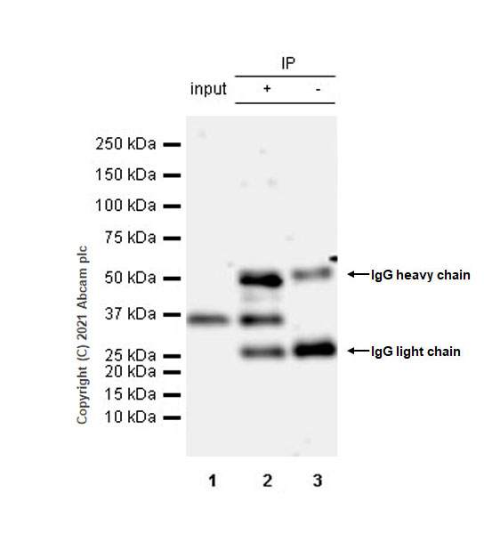 Immunoprecipitation - Anti-ING2 antibody [EPR4597-5] (AB174305)