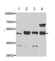 Western blot - Anti-ING3 antibody (AB189861)