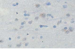 Immunohistochemistry (Formalin/PFA-fixed paraffin-embedded sections) - Anti-ING4 antibody (AB113425)