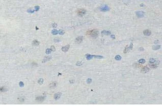 Immunohistochemistry (Formalin/PFA-fixed paraffin-embedded sections) - Anti-ING4 antibody (AB113425)