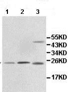 Western blot - Anti-ING4 antibody (AB113425)