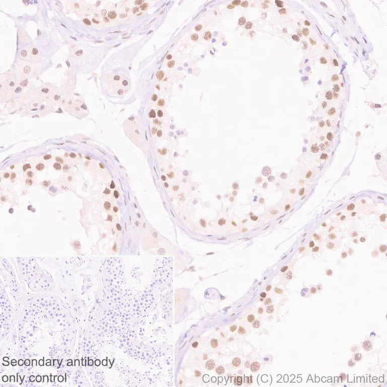 Immunohistochemistry (Formalin/PFA-fixed paraffin-embedded sections) - Anti-ING4 antibody [EPR27290-285] (AB323509)