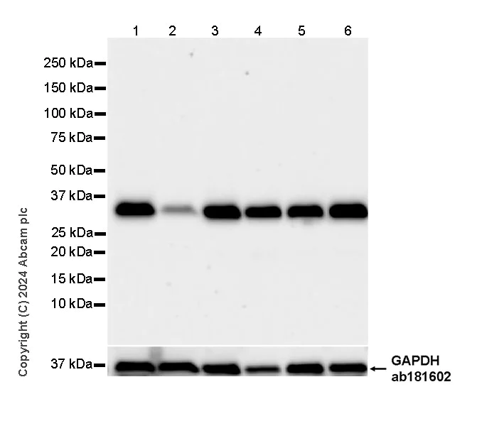 Western blot - Anti-ING4 antibody [EPR27290-285] (AB323509)