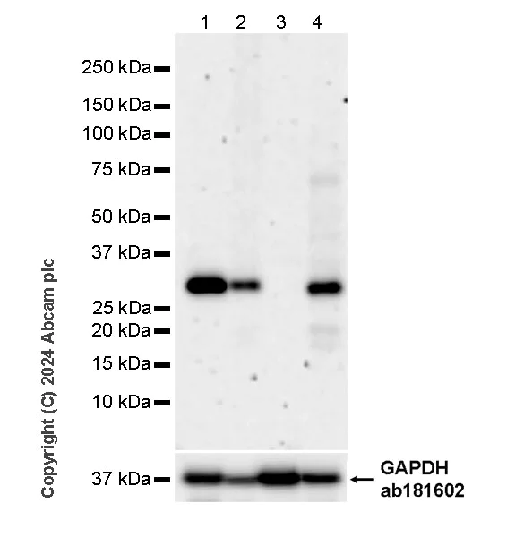 Western blot - Anti-ING4 antibody [EPR27290-285] (AB323509)
