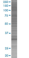 ING4 overexpression 293T lysate (whole cell)