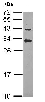 Western blot - Anti-ING5 antibody (AB96851)