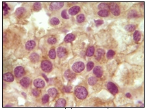 Immunohistochemistry (Formalin/PFA-fixed paraffin-embedded sections) - Anti-Inhibin alpha antibody [4A2F2] (AB47720), expandable thumbnail