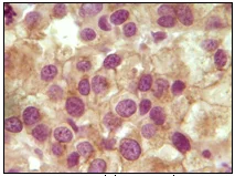 Immunohistochemistry (Formalin/PFA-fixed paraffin-embedded sections) - Anti-Inhibin alpha antibody [4A2F2] (AB47720)