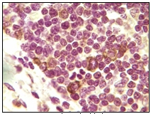 Immunohistochemistry (Formalin/PFA-fixed paraffin-embedded sections) - Anti-Inhibin alpha antibody [4A2F2] (AB47720), expandable thumbnail
