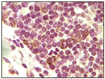 Immunohistochemistry (Formalin/PFA-fixed paraffin-embedded sections) - Anti-Inhibin alpha antibody [4A2F2] (AB47720)