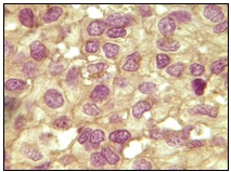 Immunohistochemistry (Formalin/PFA-fixed paraffin-embedded sections) - Anti-Inhibin alpha antibody [4A2F2] (AB47720), expandable thumbnail