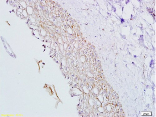 Immunohistochemistry (Formalin/PFA-fixed paraffin-embedded sections) - Anti-Inhibin alpha antibody (AB216969), expandable thumbnail