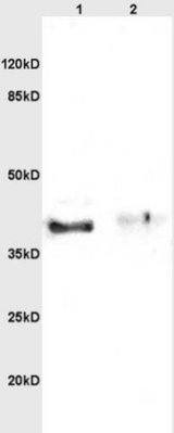 Western blot - Anti-Inhibin alpha antibody (AB216969), expandable thumbnail