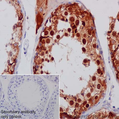 Immunohistochemistry (Formalin/PFA-fixed paraffin-embedded sections) - Anti-Inhibin alpha antibody [EPR17083] (AB203824), expandable thumbnail