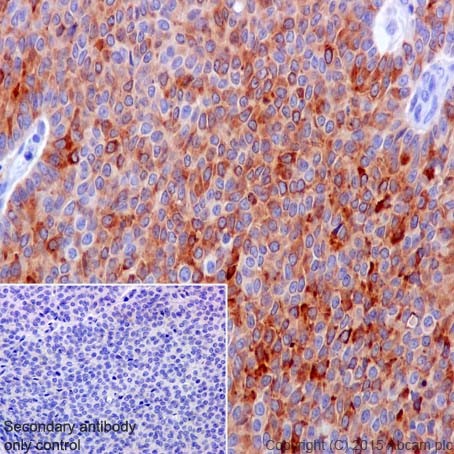 Immunohistochemistry (Formalin/PFA-fixed paraffin-embedded sections) - Anti-Inhibin alpha antibody [EPR17083] (AB203824), expandable thumbnail