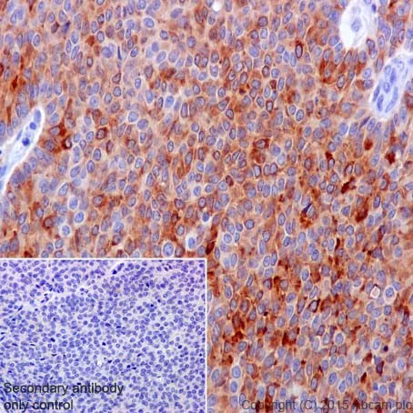 Immunohistochemistry (Formalin/PFA-fixed paraffin-embedded sections) - Anti-Inhibin alpha antibody [EPR17083] - BSA and Azide free (AB251401)
