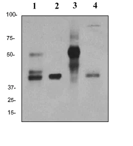 Western blot - Anti-Inhibin alpha antibody [EPY2782] (AB81322)