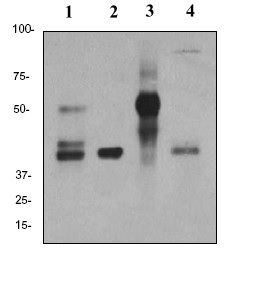 Western blot - Anti-Inhibin alpha antibody [EPY2782] - BSA and Azide free (AB226844), expandable thumbnail