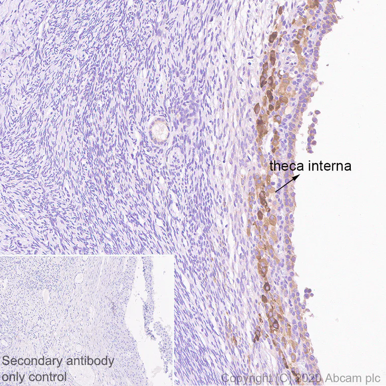 Immunohistochemistry (Formalin/PFA-fixed paraffin-embedded sections) - Anti-Inhibin alpha antibody [PO12/8] (AB273454)