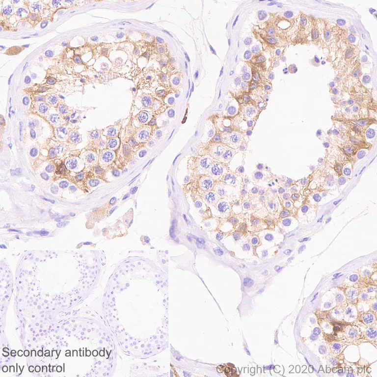 Immunohistochemistry (Formalin/PFA-fixed paraffin-embedded sections) - Anti-Inhibin alpha antibody [PO12/8] - BSA and Azide free (AB273486)